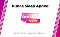 Sleep Apnea: Punca Sleep Apnea