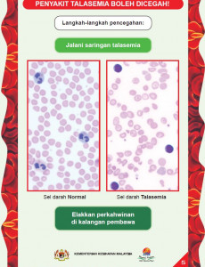 Talasemia:Pameran Talasemia 01 BM 05