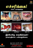 Merokok:Amaran Merokok Bergambar (B.Tamil)