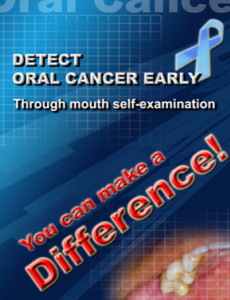 Oral Cancer