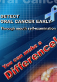 Oral Cancer