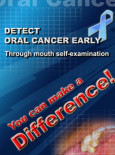 Oral Cancer