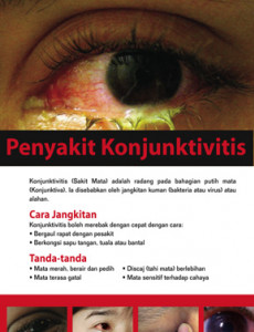 Conjuntivitis : Cara Jangkitan