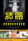 Paru-paru:Kanser Paru-paru (B.Cina)
