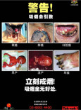 Merokok:Tak Nak Merokok (B.Cina)
