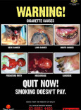 Merokok:Tak Nak Merokok (B.Inggeris)