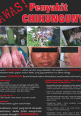 Chikungunya (B. Malaysia)