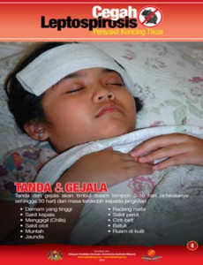 Leptospirosis: Tanda & Gejala