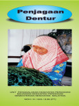 Dentur:Penjagaan Dentur