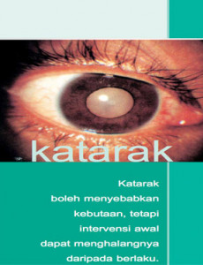 Katarak (Bahasa Malaysia)