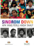 Sindrom Down