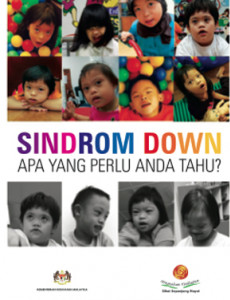 Sindrom Down