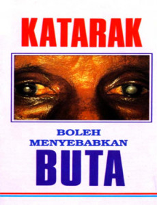 Katarak