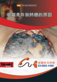 Merokok Penyebab Kanser Paru-paru (B. Cina)