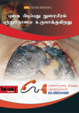 Merokok Penyebab Kanser Paru-paru (B. Tamil)