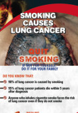 Merokok penyebab kanser paru-paru (BI)