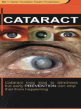 Cataract