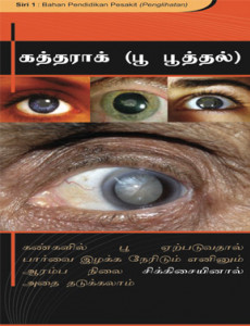 Katarak (Bahasa Tamil) 