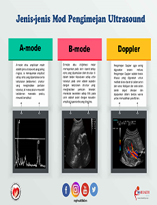 Jenis-jenis Mod Pengimejan Ultrasound