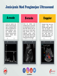 Jenis-jenis Mod Pengimejan Ultrasound