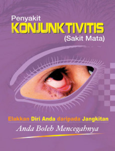 KONJUNKTIVITIS:Penyakit KONJUNKTIVITIS (Sakit Mata)