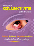 KONJUNKTIVITIS:Penyakit KONJUNKTIVITIS (Sakit Mata)