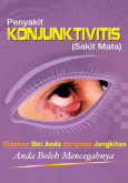 KONJUNKTIVITIS:Penyakit KONJUNKTIVITIS (Sakit Mata)