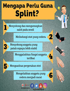Mengapa Perlu Guna Splint