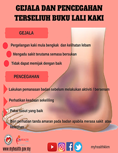 Gejala Dan Pencegahan Terseliuh Buku Lali Kaki