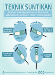 Teknik Suntikan