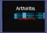 Arthiritis (B. Inggeris)