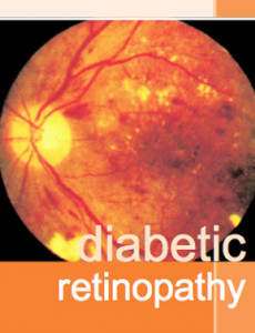 Diabetic Retinopathy