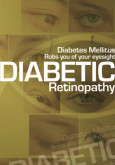 Diabetik Retinopati (Bahasa Inggeris)