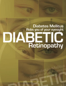 Diabetik Retinopati (Bahasa Inggeris)