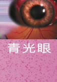 Glaukoma (B.Cina)