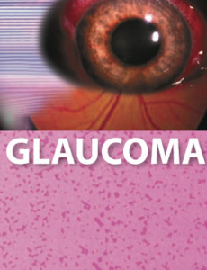 Glaukoma (B.Inggeris)