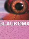 Glaukoma (B.Malaysia)