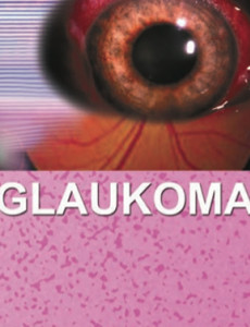 Glaukoma (B.Malaysia)