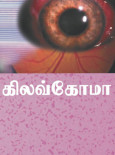 Glaukoma (B.Tamil)