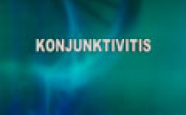 Konjunktivitis