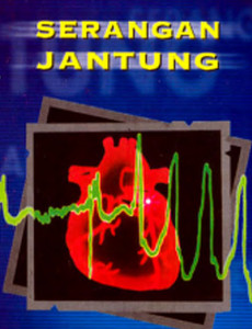 Jantung:Serangan Sakit Jantung 