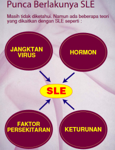 SLE 7