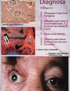 SLE 11