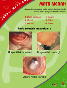 Mata:Pameran Kenali Mata Anda 17