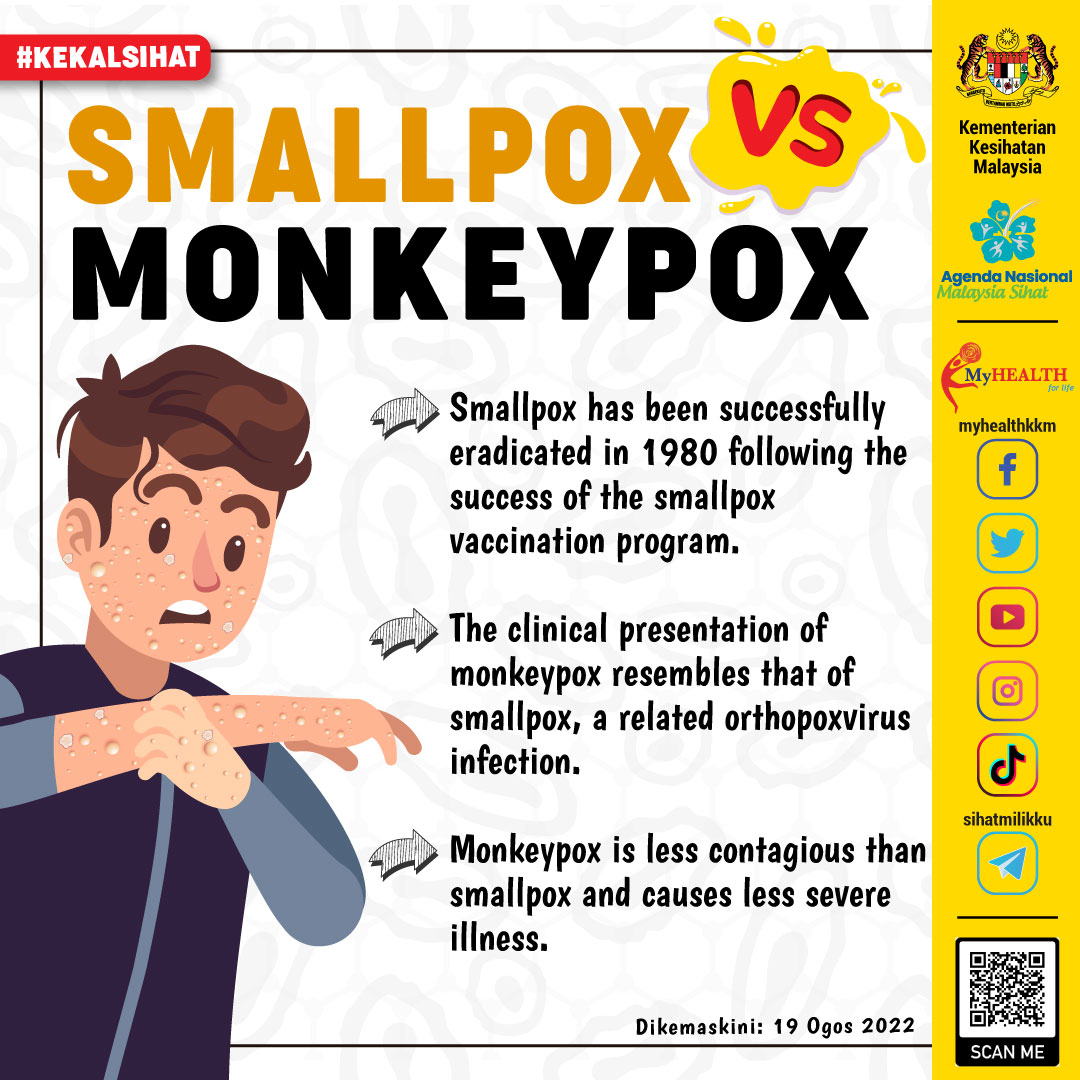 SmallPox VS MonkeyPox - Info Sihat | Bahagian Pendidikan Kesihatan ...