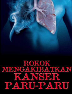 Rokok Mengakibatkan Kanser Paru-paru 