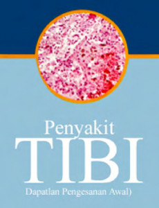 Tibi