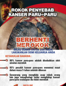 Merokok penyebab kanser paru-paru (BM)