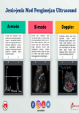 Jenis-jenis Mod Pengimejan Ultrasound