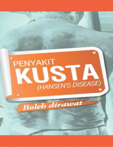 Kusta:Penyakit Kusta Boleh Dirawat